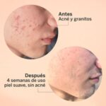 Exfoliante Aha/Bha Serum 30ml Segle - Image 4