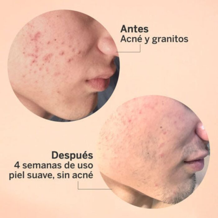 Exfoliante Aha/Bha Serum 30ml Segle - Image 4