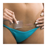 Parche 15l x 3.60a Cesarea Scaraide (GVI)