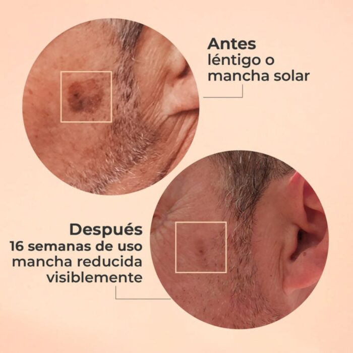 Glicolmix Serum 30ml Segle - Image 3