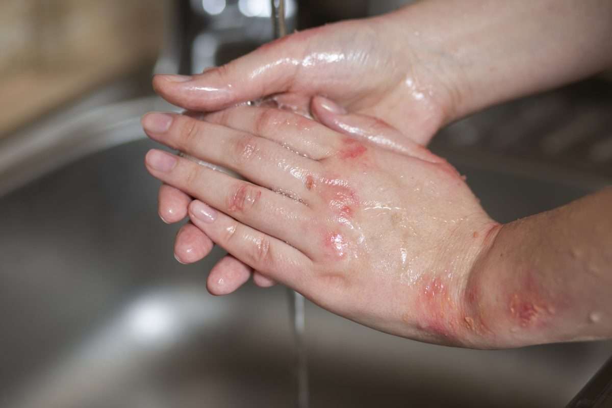 Reduce la inflamación de forma eficaz