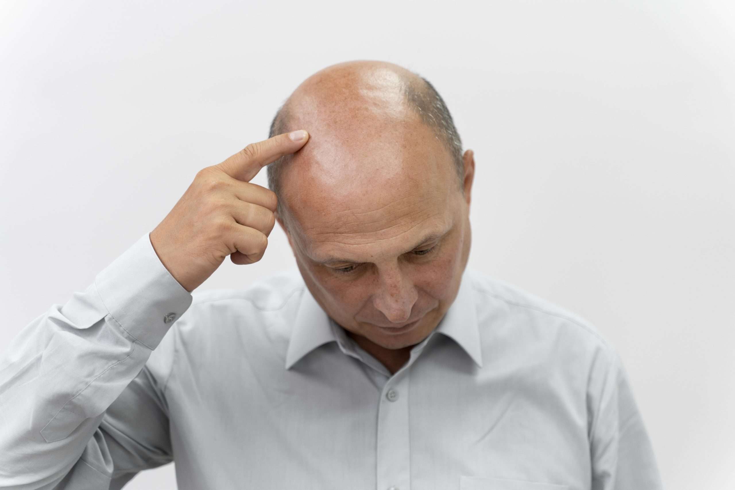Tratamiento para la caída del cabello