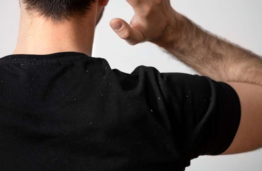 Pilexil Shampoo Caspa Seca 300Ml Armstrong