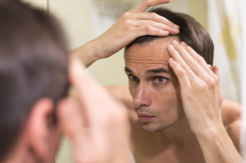 Minoxidil 5 mg en capsulas