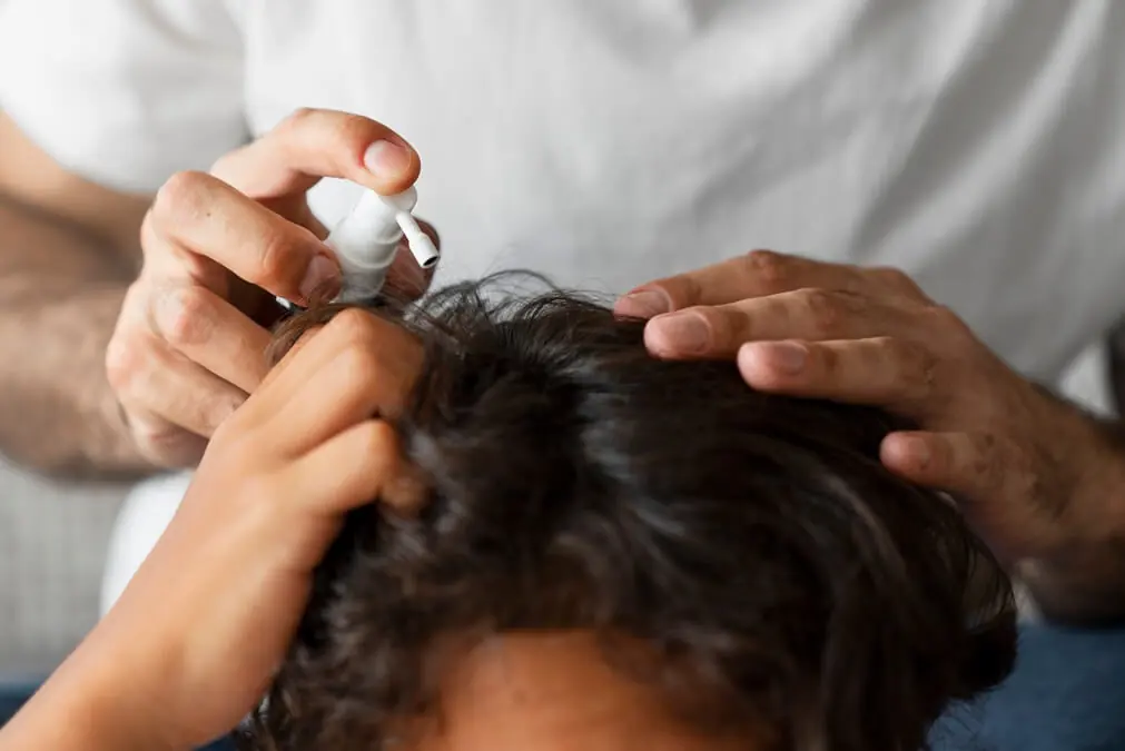 high angle hand holding lice treatment 1
