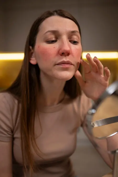 woman looking her rosacea mirror 1
